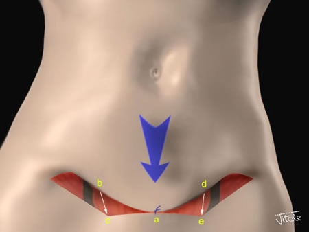 Combien Ça Coûte Pour Une Abdominoplastie? - VotreSante.Club 1 03-le ventre-01