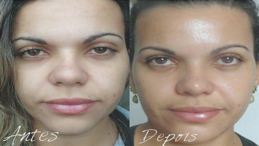 Vitanol Pour Des Taches Cela Fonctionne? Avant-et-Après Comment Utiliser les trucs et Astuces 3 6aboaforma