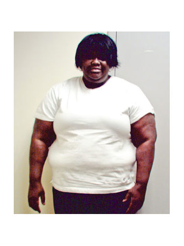 Laissez-vous inspirer: 15 la Transformation du Corps est Incroyable 57 7wboaforma