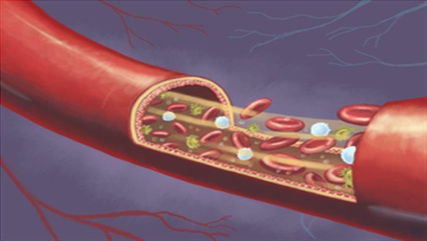 10 Avantages du Thé, de Romarin - Qu'est-il Pour les, Conseils de 4 Blood_Circulation