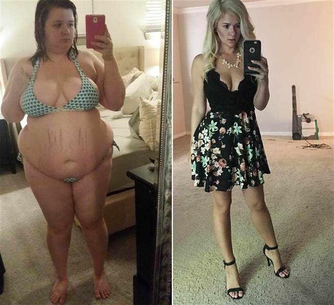 Les femmes Est la Chirurgie Bariatrique, Mais Seulement réussi à Perdre 68 kg), Avec le Changement des Habitudes 8 carter2