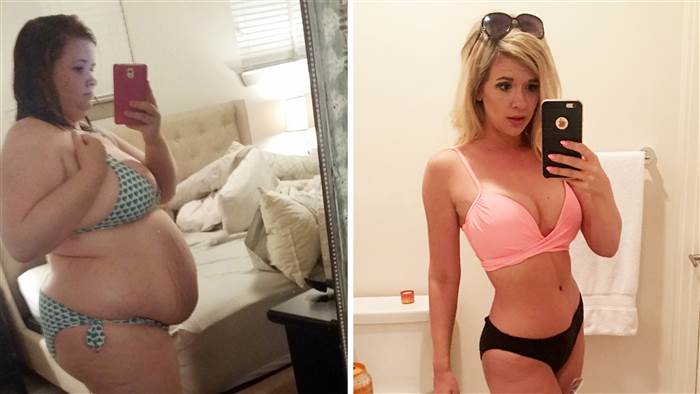 Les femmes Est la Chirurgie Bariatrique, Mais Seulement réussi à Perdre 68 kg), Avec le Changement des Habitudes 14 votresante.club votresante.club christine carter