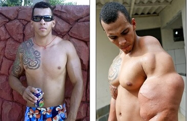 Été un fan de l'Incroyable Hulk est de mettre un Dangereux Cocktail dans ses Bras, et Presque doit Être de Coupe off 16 votresante.club votresante.club hulk2