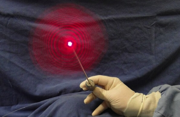 La liposuccion Laser - comment il Fonctionne et Comment Conseils 6 votresante.club votresante.club laser lipo
