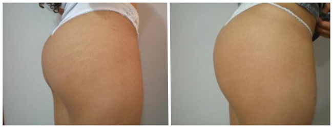 Comment faire le dernier Tronçon 1 make-up-bum