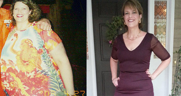 La femme de 51 Ans, Refuse de la Chirurgie Bariatrique et de perdre du poids à 40 kg) pour leur Propre Compte 22 votresante.club votresante.club peso sem bariatrica