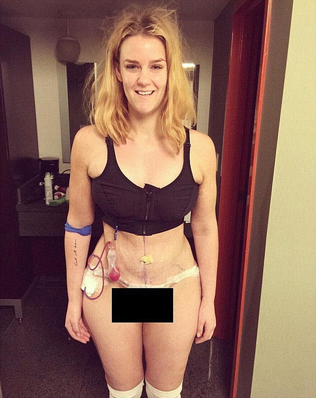 La jeune femme a Perdu 92 lbs et Montre son Incroyable Transformation sur les Réseaux Sociaux 28 simone-16