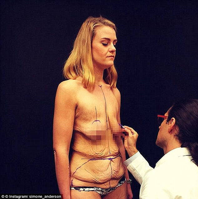 La jeune femme a Perdu 92 lbs et Montre son Incroyable Transformation sur les Réseaux Sociaux 27 simone-17