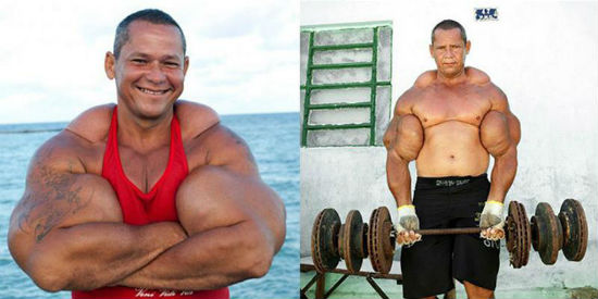 Synthol - C'est, Pourquoi est-ce Qu'ils sont Nombreux à l'Utiliser, Comment il Fonctionne, et les Risques 1 votresante.club votresante.club synthol4