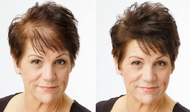 Viva Cheveux-T-Il? Dans la formule, des Témoignages, des Avant-et-Après - 1 votresante.club votresante.club viva hair4